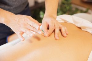 acupunctura